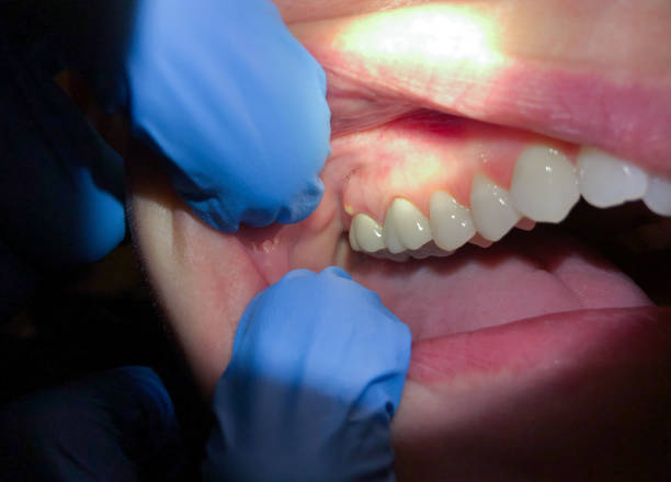 Best 24-Hour Emergency Dental Care in Chetopa, KS
