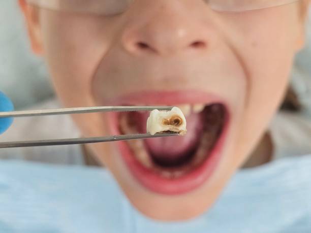 Best Walk-In Emergency Dental Services in Chetopa, KS