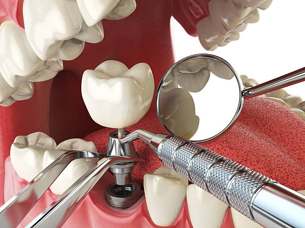 Best Emergency Denture Repair in Chetopa, KS